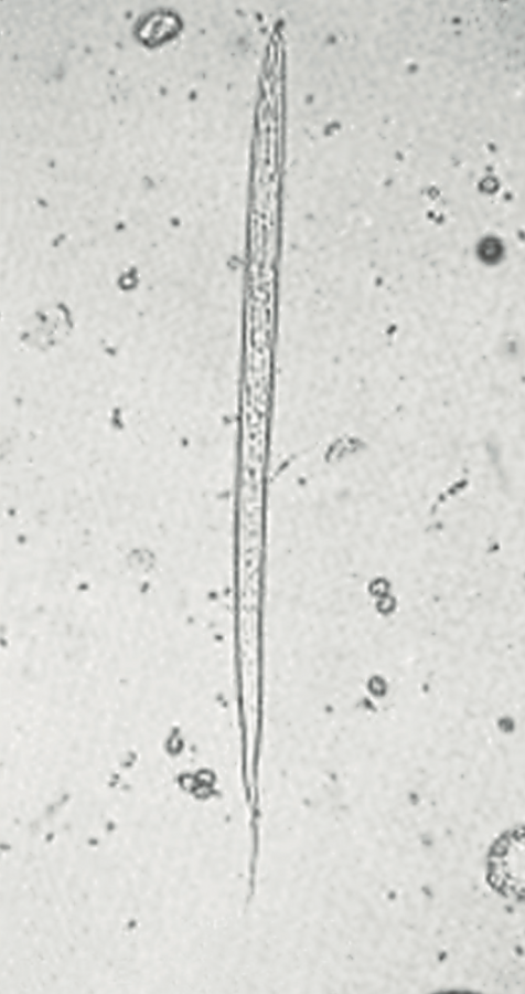 Larve de Bunostomum ©Collection Pr Gevrey